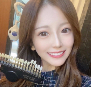 セルフホワイトニングだからこその低価格